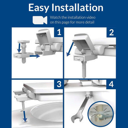 Aurora Slow Close Toilet Seat, Easy Clean Hinges and Adjustable Perfect Fit Plastic Seat, Made in USA, Elongated, White